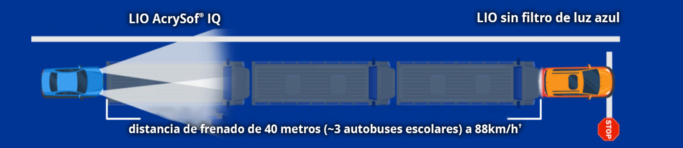 Ilustración que muestra un marco etiquetado como LIO AcrySof y un coche etiquetado como LIO sin filtro de luz azul. El texto dice: “distancia de frenado a 88 km/h de +40 metros (~3 autobuses).”