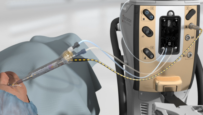 Imagem animada do CENTURION Vision System e Caneta ACTIVE SENTRY junto de um paciente numa cirurgia. A linha tracejada amarela indica o sensor de pressão de irrigação localizado na Caneta ACTIVE SENTRY.  