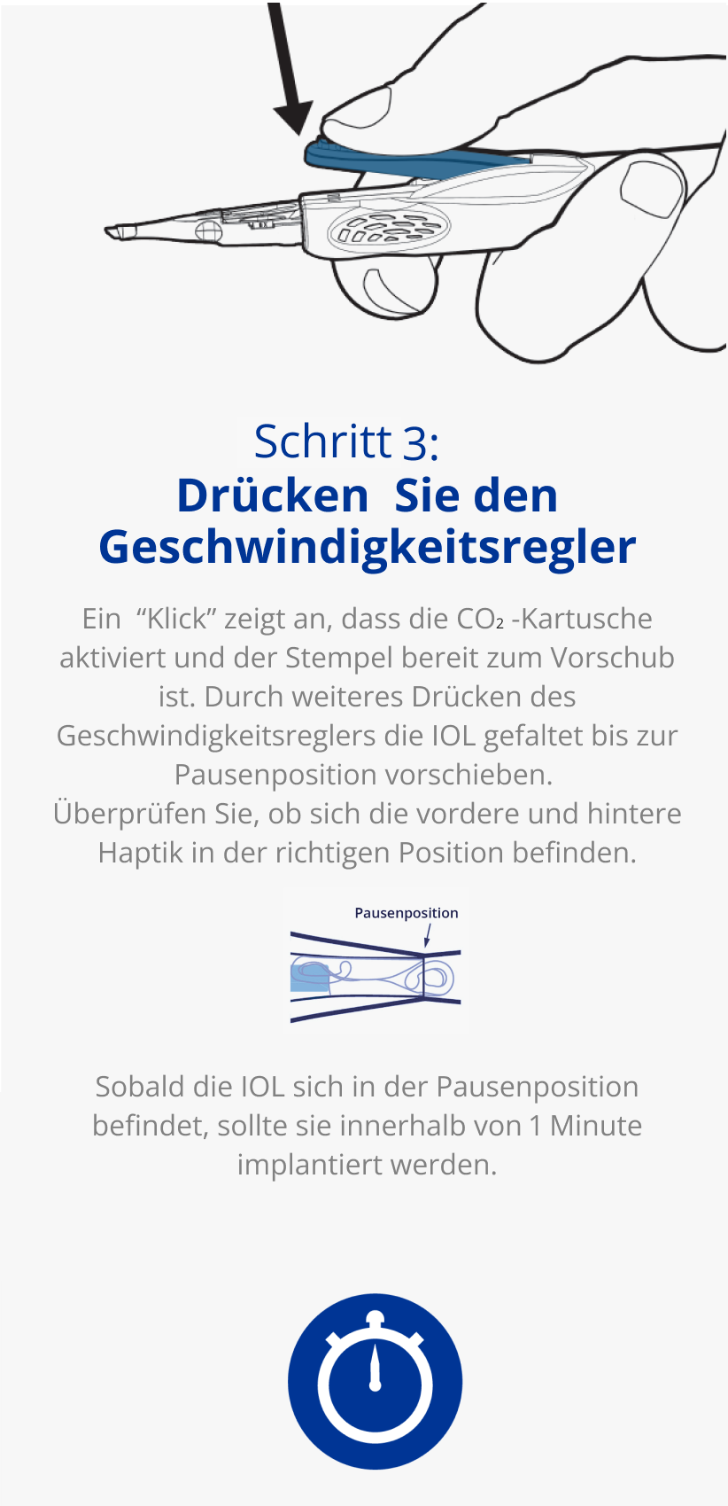 Illustration des AutonoMe® Implantationssystems, die einen Ausschnitt der Kartuschenspitze und des Stempels mt der IOL zeigt. Ein dunkelblauer Pfeil zeigt auf die gefaltete IOL in der Kartusche mit einem Text der besagt: “Pausenposition”. Illustration einer Hand, die das AutonoMe® Implantationssystem hält. Ein schwarzer Pfeil zeigt die Druckbewegung auf den Geschwindigkeitsregler an. Blaues Symbol einer Uhr.