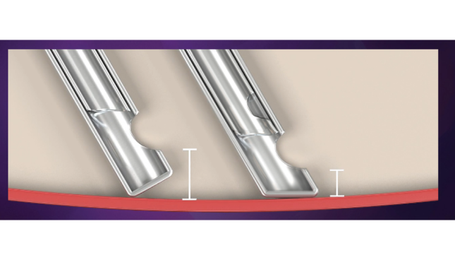 Imagen de dos puntas de sonda, una biselada y otra plana. La imagen ilustra que la punta biselada permite acercarse más a la retina.