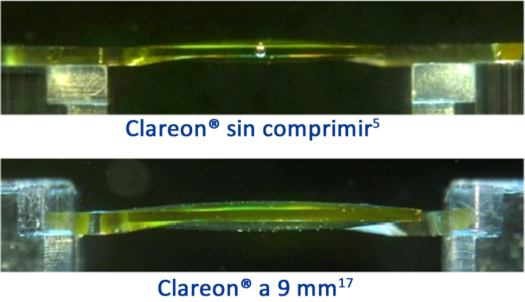 Imagen de la LIO Clareon desde el lateral que muestra la forma de la LIO sin comprimir. Imagen de la LIO Clareon desde el lateral que muestra la forma de la LIO con una compresión de 9 mm.