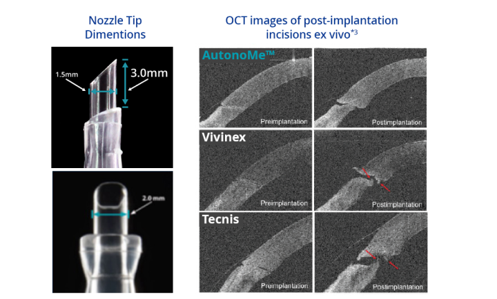 Two related images beside each other. The first image is a close-up of the AutonoMe nozzle tip, with text indicating that the length of the tip is 3.0mm, and diameter of the tip is 2.0mm. Blue text at the top of this image reads “Nozzle Tip Dimensions.” The second image is of the pre- and post- implantation process for AutonoMe, Vivinex, and Tecnis. Blue text at the top of this image reads “OCT images of post-implantation incisions ex vivo.” Red arrows on top of the Vivinex and Tecnis images point to membrane tearing post implantation ex vivo.