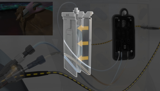 Imagen animada del CENTURION Vision System y de la pieza de mano ACTIVE SENTRY junto a un paciente siendo operado. Las flechas amarillas destacan las placas de compresión ajustando la presión de la bolsa de solución estéril BSS.