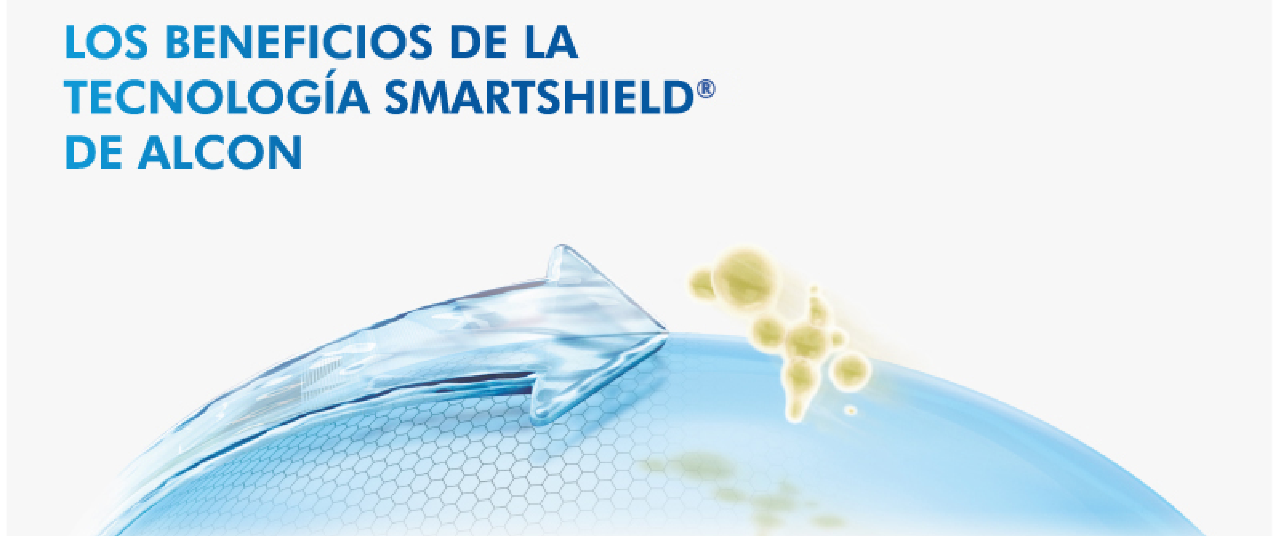 Smartshield technology benefits