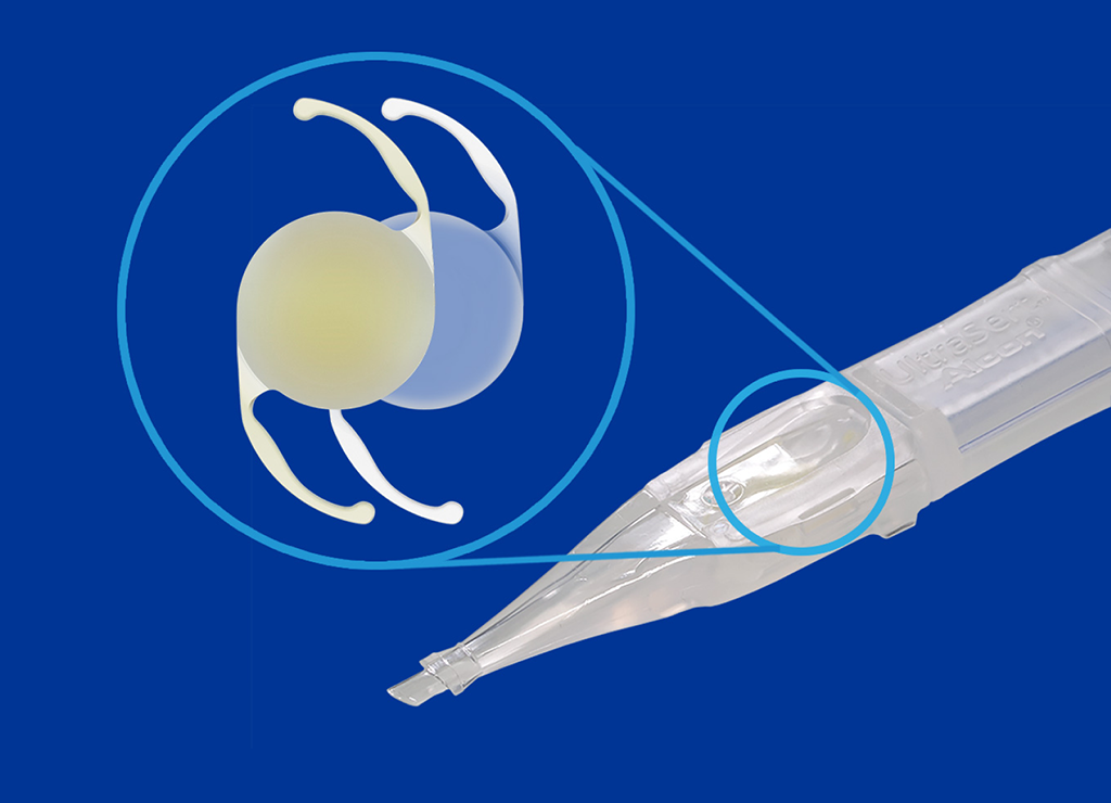 UltraSert Preloaded Delivery System with a circle over the device to indicate where you would input the AcrySof IQ IOL. A close-up 3-dimensional image of two IOLs sit to the left the UltraSert Delivery System.