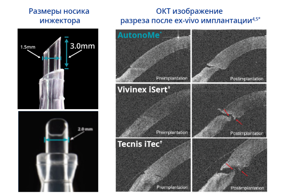 Два связанных изображения рядом друг с другом. Первое изображение представляет собой крупный план наконечника сопла AutonoMe с текстом, указывающим на то, что длина наконечника составляет 3,0 мм, а диаметр - 2,0 мм. Синий текст в верхней части изображения гласит: "Размеры наконечника сопла".    Второе изображение представляет собой процесс до и после имплантации для AutonoMe, Vivinex и Tecnis. Синий текст в верхней части этого изображения гласит: "ОКТ-изображения постимплантационных разрезов ex vivo". Красные стрелки в верхней части изображений Vivinex и Tecnis указывают на разрыв мембраны после имплантации ex vivo.