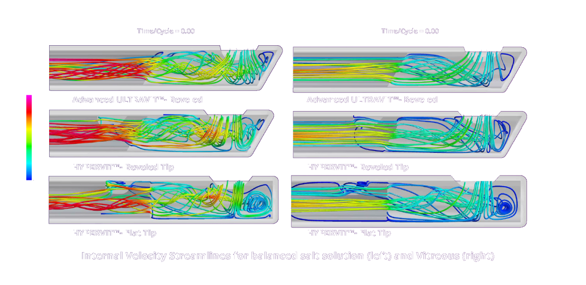 An image comparing the back flow with Advanced ULTRAVIT, HYPERVIT Beveled Tip and HYPERVIT Flat Tip probes in balanced salt solution and vitreous. The HYPERVIT Beveled Tip has reduced back flow compared to the other probes.