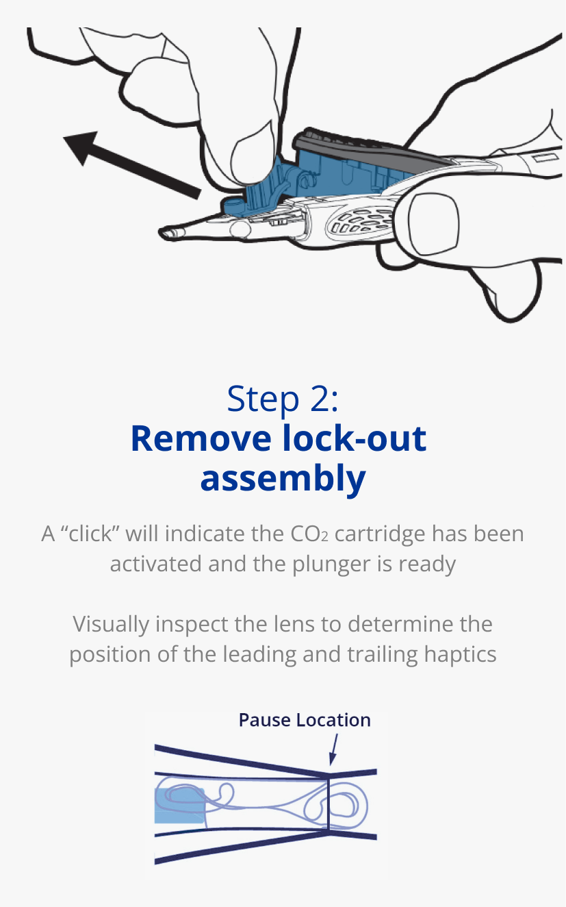 Illustration of a hand holding an AutonoMe Delivery System. A black arrow points away from the device’s cartridge to indicate a pulling movement. Illustration of an AutonoMe Delivery System’s plunger/cartridge piece. A dark blue arrow points towards the folded IOL in the AutonoMe cartridge with text that reads “Pause Location.”  