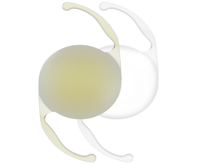 3-dimensional image of a yellow AcrySof IQ Monofocal IOLs and a clear AcrySof IQ Monofocal IOLs side-by-side.